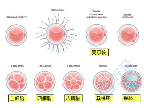 试管婴儿-海外试管婴儿