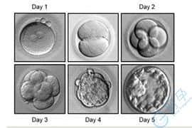 鲜胚、囊胚、冻胚-试管婴儿