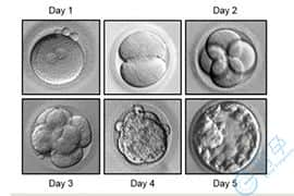 美国试管婴-冷冻胚胎移植