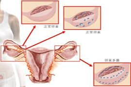 高龄女性试管-做试管要注意什么