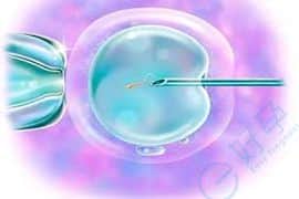 美国试管婴儿- 胚胎移植-养囊