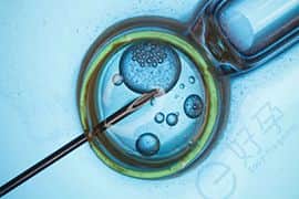 美国CFG生殖中心-第三代试管婴儿-多囊卵巢综合症
