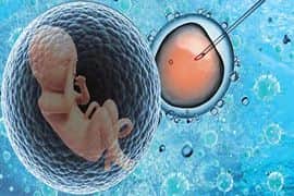 美国试管婴儿预防胎儿染色体异常是重点