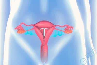 子宫内膜增厚如何做试管？试管流程详细介绍