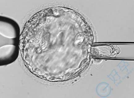 女性不排卵还可以做三代试管婴儿吗？试管婴儿步骤讲解