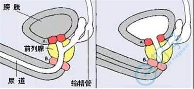 E好孕科普|什么是逆行射精？精子都跑哪里去了？