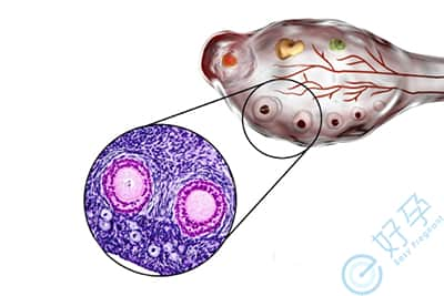 试管卵子不成熟怎么办？E好孕教你如何提升卵子质量