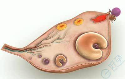 3点导致卵泡发育不良的因素，怎么治疗才能早日好孕？