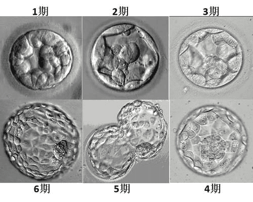 试管婴儿取卵后，胚胎培养需要多久？