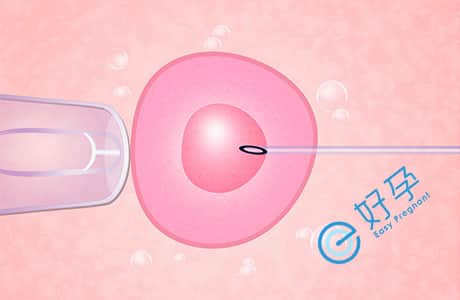 e好孕：雌二醇对试管婴儿的影响？