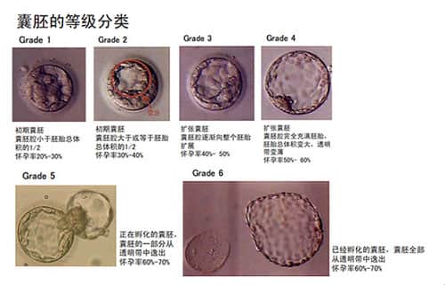 囊胚，发育潜能是关键！试管婴儿到底要不要养囊？