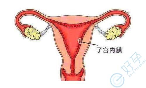 45岁女性子宫内膜薄，去泰国做试管婴儿的成功率有多少？