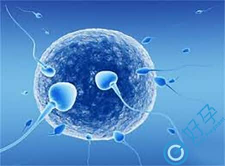 优质精子的六大标准 精子质量达标实现好孕