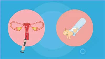子宫内膜异位症不孕，泰国试管如何提高受孕率?