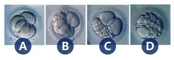 胚胎碎片率高怎么办?泰国试管婴儿针对性措施
