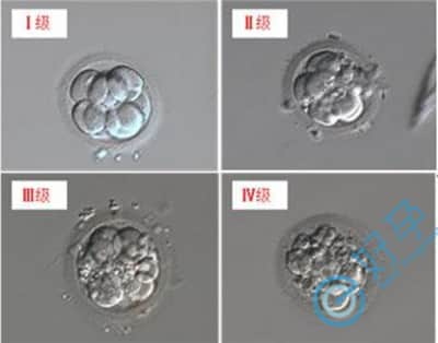 第三代试管婴儿囊胚培养的目的是什么，养囊成功率高吗？