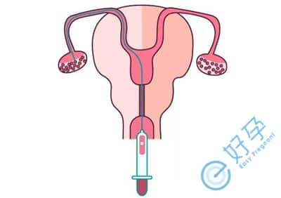 针对多囊及输卵管不好的情况，怎么办？