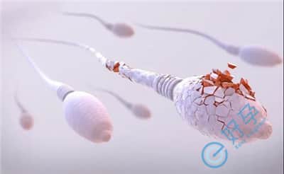 男性精子DNA碎片率高，做试管婴儿如何提高成功率？