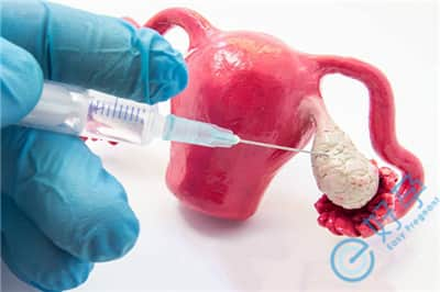 Copy-of-IVM-vs.-IVF_-750x675.jpg