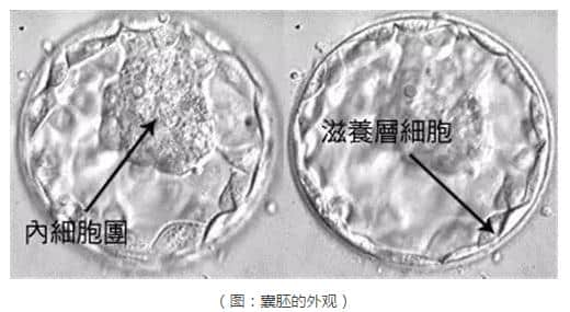 试管婴儿助孕师是如何提取囊胚滋养层细胞的呢？