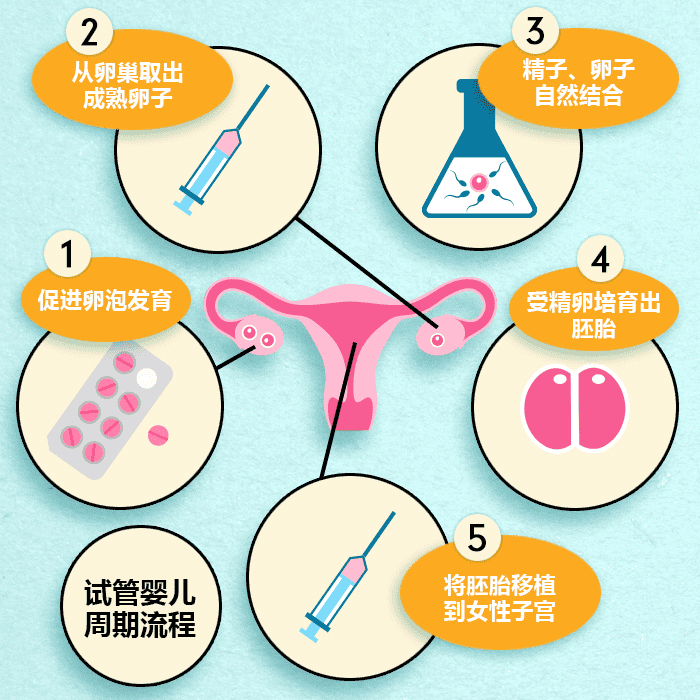 试管婴儿全程都有哪些步骤，E好孕给您详细讲解