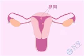 患有子宫内膜息肉想做试管婴儿，如何好孕呢？