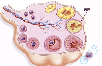 黄体功能不全对试管周期有影响吗?试管前如何调理？