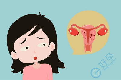 女性患有子宫内膜异位症，做试管的成功率高吗？