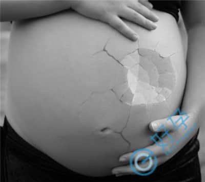 子宫纵膈如何赢好孕？看看试管婴儿技术是如何助孕的吧
