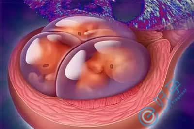 试管双胎风险有哪些，一次放两个胚胎需要哪些条件
