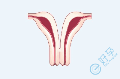 子宫纵膈一定会造成不孕吗？看完这个再决定切与不切
