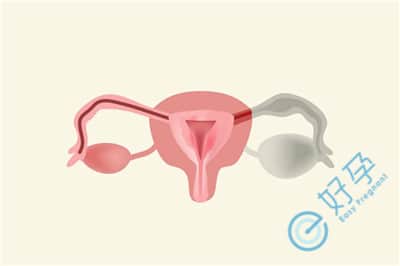卵巢囊肿还会引起并发症吗？如何做试管婴儿？