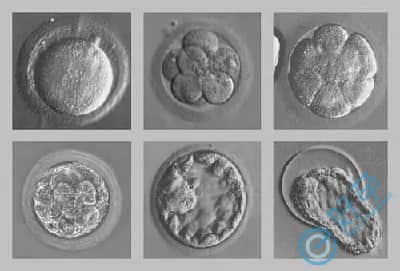 胚胎质量差分裂速度慢是什么原因导致的？