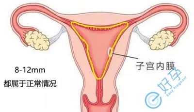 做试管婴儿为什么移植后要补充黄体酮？