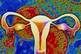 子宫内膜结核做试管婴儿，需要做第几代？