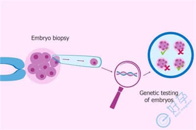 高龄做试管婴儿怎么预防胚胎异常、提高成功率？
