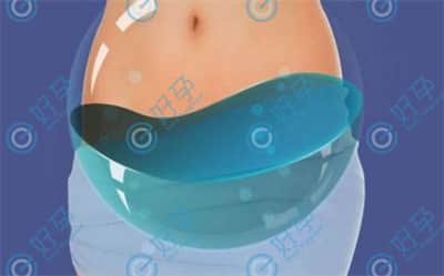 试管婴儿所服用的促排卵药会引起腹部积水吗？