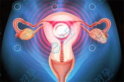 宫颈性不孕的原因与试管婴儿的解决方案