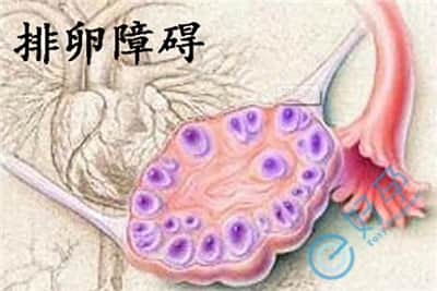 排卵障碍.jpg
