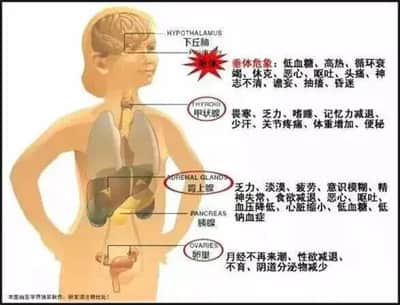 泰国第三代试管婴儿可以避免席汉氏综合症吗？