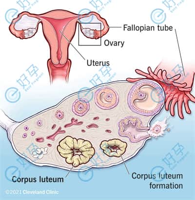  子宫内膜异位症不孕，做试管如何提高受孕率?