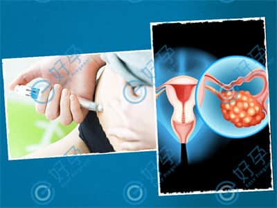 卵巢囊肿会影响做试管吗，好孕率如何保障？