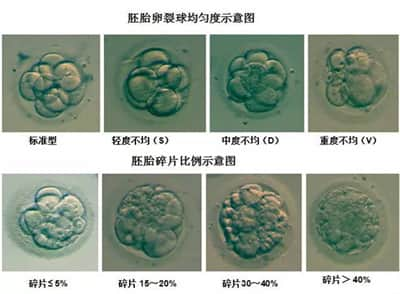 试管胚胎碎片率高是卵子原因还是精子问题？