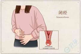 导致闭经的原因有哪些？可以做试管婴儿吗？
