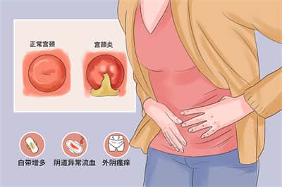宫颈炎对怀孕有什么影响？做试管婴儿成功率高吗？