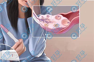 血糖高对卵泡有影响吗？做试管婴儿如何获取优质卵子？