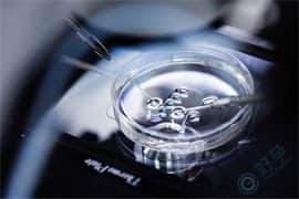 精子DFI碎片率高，做试管婴儿是如何提高受孕率的？