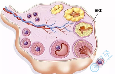 详解：黄体功能不全对试管婴儿周期的影响