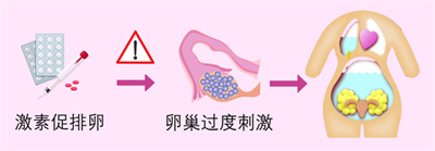做试管对女性身体究竟有无伤害？过程中是否会导致卵巢过度刺激？