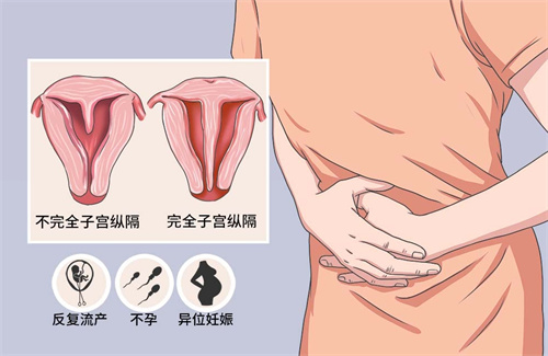 女性如果子宫有异常病变，会有六类相关信号的释放！